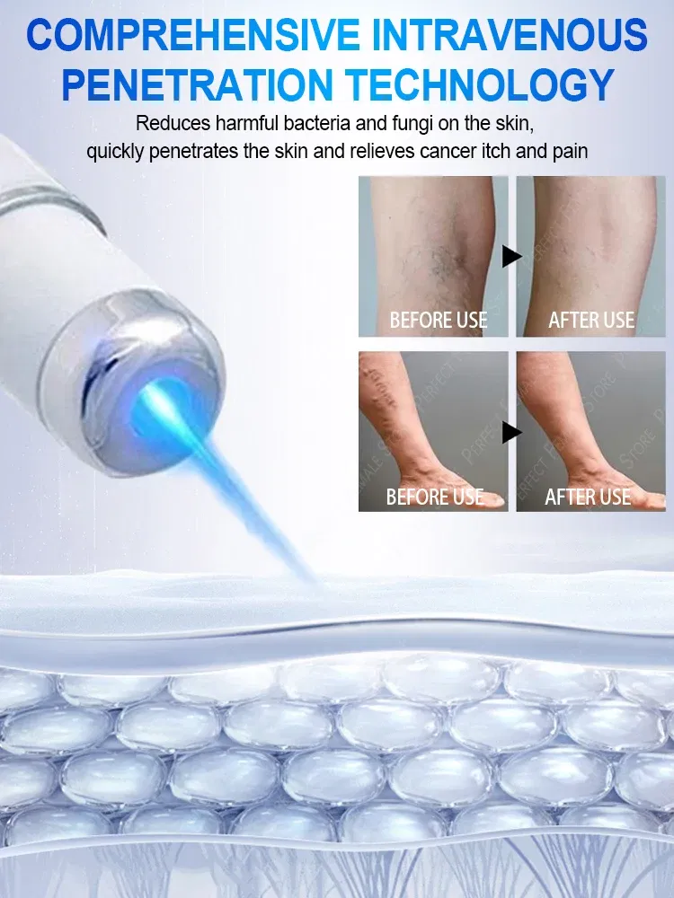 Color: green - Varicose Veins Products