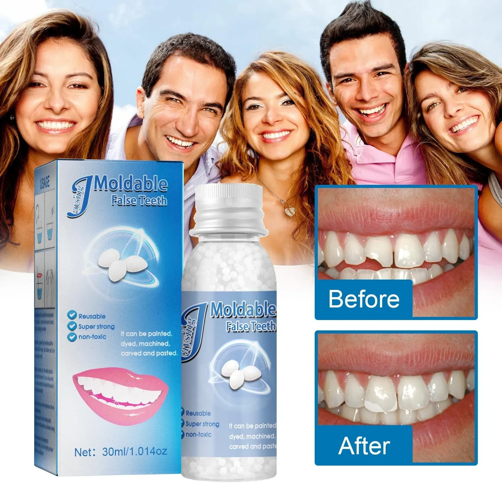 Moldable Temporary tooth Repair Kit
