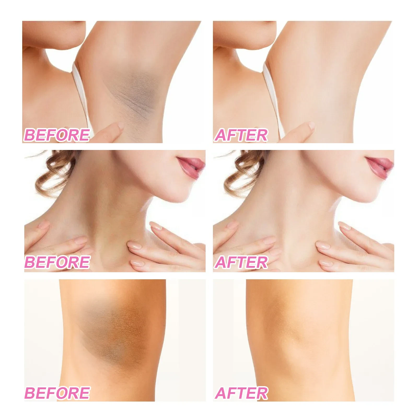 Moisturizing Skin Refreshing And Smooth Removing Color