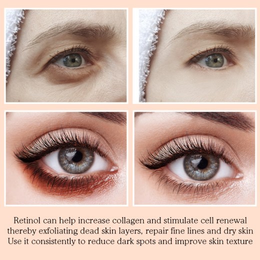 Eye Mask Fades Dark Circles, Nourishes The Eyes and Improves Fine Lines